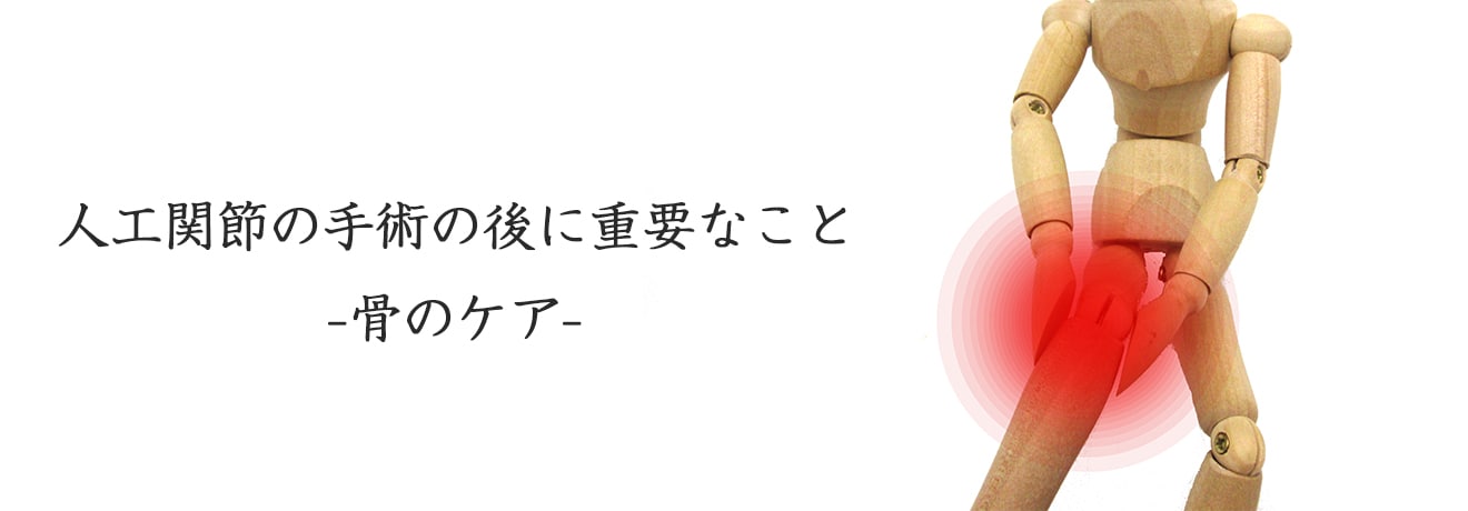 20170626